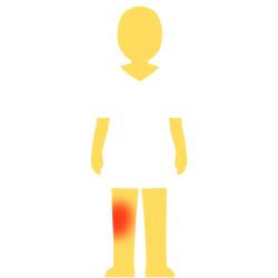 A person with no hair or face, an emoji yellow skintown, and a white pair of shorts and pants with no visible divider between the two. there's a glowing red spot on their left knee.